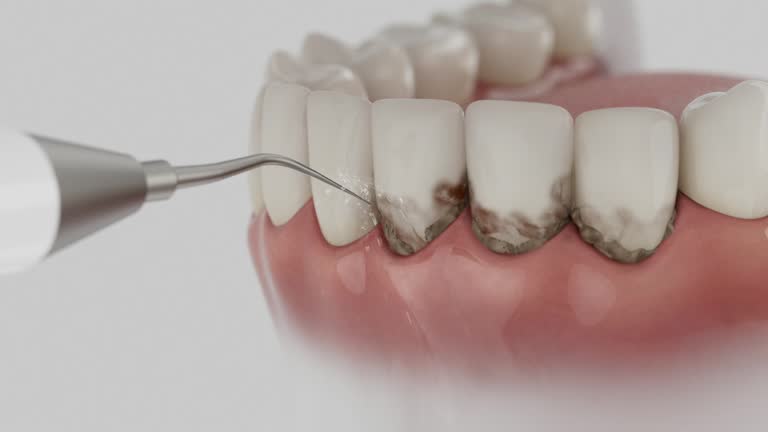 Trusted Teeth Cleaning And Checkup service in John Day, OR - Dentist Open Now